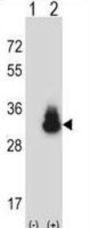 Carcinoembryonic Antigen Related Cell Adhesion Molecule 3 (CEACAM3) Antibody