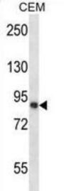 Calpain-11 (CAPN11) Antibody