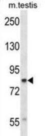 Cullin 4A (CUL4A) Antibody