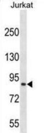 Cullin 4A (CUL4A) Antibody