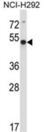 Actin-Related Protein 6 (ACTR6) Antibody