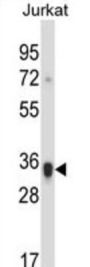 Killer Cell Immunoglobulin-Like Receptor 2DS1 (KIR2DS1) Antibody
