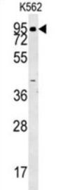 Amine Oxidase Copper Containing 1 (AOC1) Antibody