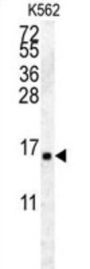 Histone H2A Type 2-A (HIST2H2AA4) Antibody