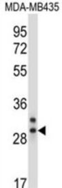 CELA2A Antibody