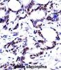 Heterogeneous Nuclear Ribonucleoprotein M (HNRNPM) Antibody