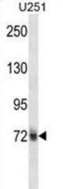 Heterogeneous Nuclear Ribonucleoprotein M (HNRNPM) Antibody