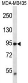 TRPV2 Antibody