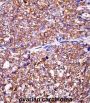 Eukaryotic Translation Initiation Factor 5A-2 (EIF5A2) Antibody