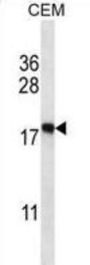 Eukaryotic Translation Initiation Factor 5A-2 (EIF5A2) Antibody