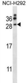 Neurturin (NRTN) Antibody