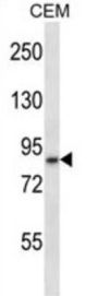 Disintegrin And Metalloproteinase Domain-Containing Protein 11 (ADAM11) Antibody