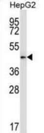 Mouse Pdk2 Antibody
