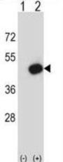 Mouse Pdk2 Antibody