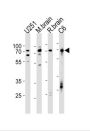 Far Upstream Element (FUSE) Binding Protein 1 (FUBP1) Antibody