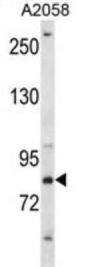 CREB-Regulated Transcription Coactivator 2 (CRTC2) Antibody