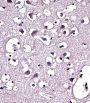 Lipoprotein Lipase (LPL) Antibody