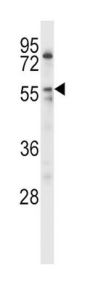 Lipoprotein Lipase (LPL) Antibody
