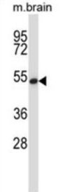 General Transcription Factor IIH, Polypeptide 1 (GTF2H1) Antibody