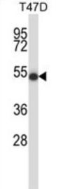 Palmitoyltransferase ZDHHC16 (ZDH16) Antibody