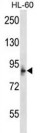 Microcephalin (MCPH1) Antibody