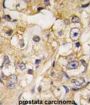 DRAGON Antibody