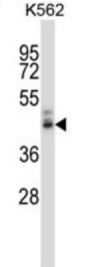 Pancreatic Polypeptide Receptor 1 (PPYR1) Antibody