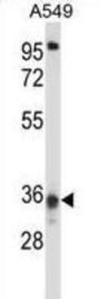 Coiled-Coil Domain Containing 50 (CCDC50) Antibody