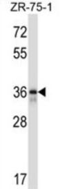 Fetuin B (FETUB) Antibody