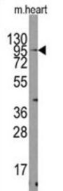 Mouse TRPV3 Antibody