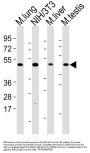 Mixed Lineage Kinase Domain-Like Protein (MLKL) Antibody