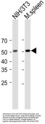Mixed Lineage Kinase Domain-Like Protein (MLKL) Antibody