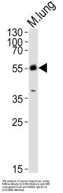 Mixed Lineage Kinase Domain-Like Protein (MLKL) Antibody