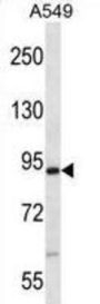 Mouse Nek4 Antibody
