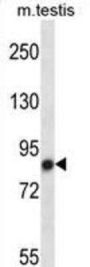Mouse Nek4 Antibody