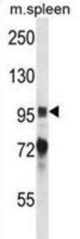 Protein-Tyrosine Kinase 2-Beta (Ptk2b) Antibody