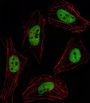 Pituitary Homeobox 2 (PITX2) Antibody
