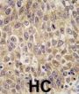 Alpha-Fetoprotein (AFP) Antibody