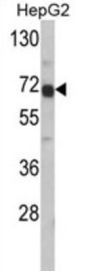 Alpha-Fetoprotein (AFP) Antibody