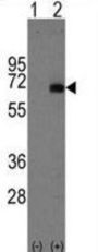 Alpha-Fetoprotein (AFP) Antibody