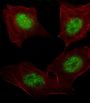 Aryl Hydrocarbon Receptor Nuclear Translocator (ARNT) Antibody