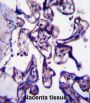 CREB-Regulated Transcription Coactivator 2 (CRTC2) Antibody