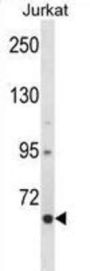 CREB-Regulated Transcription Coactivator 2 (CRTC2) Antibody