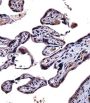 IL9R Antibody