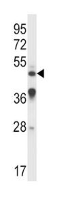 IL9R Antibody