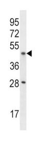 IL9R Antibody