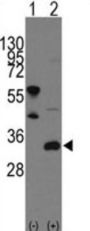 Frequently Rearranged In Advanced T-Cell Lymphomas 1 (FRAT1) Antibody