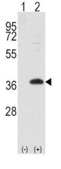 Frequently Rearranged In Advanced T-Cell Lymphomas 1 (FRAT1) Antibody