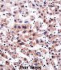 Calcipressin-3 (RCAN3) Antibody