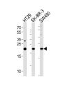 HAND1 Antibody